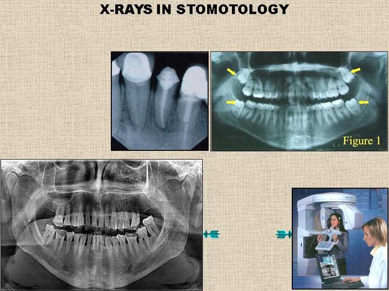 X-RAYS IN STOMOTOLOGY